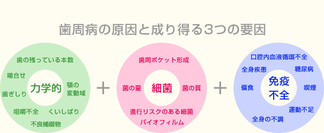 歯周病の原因と成り得る3つの要因